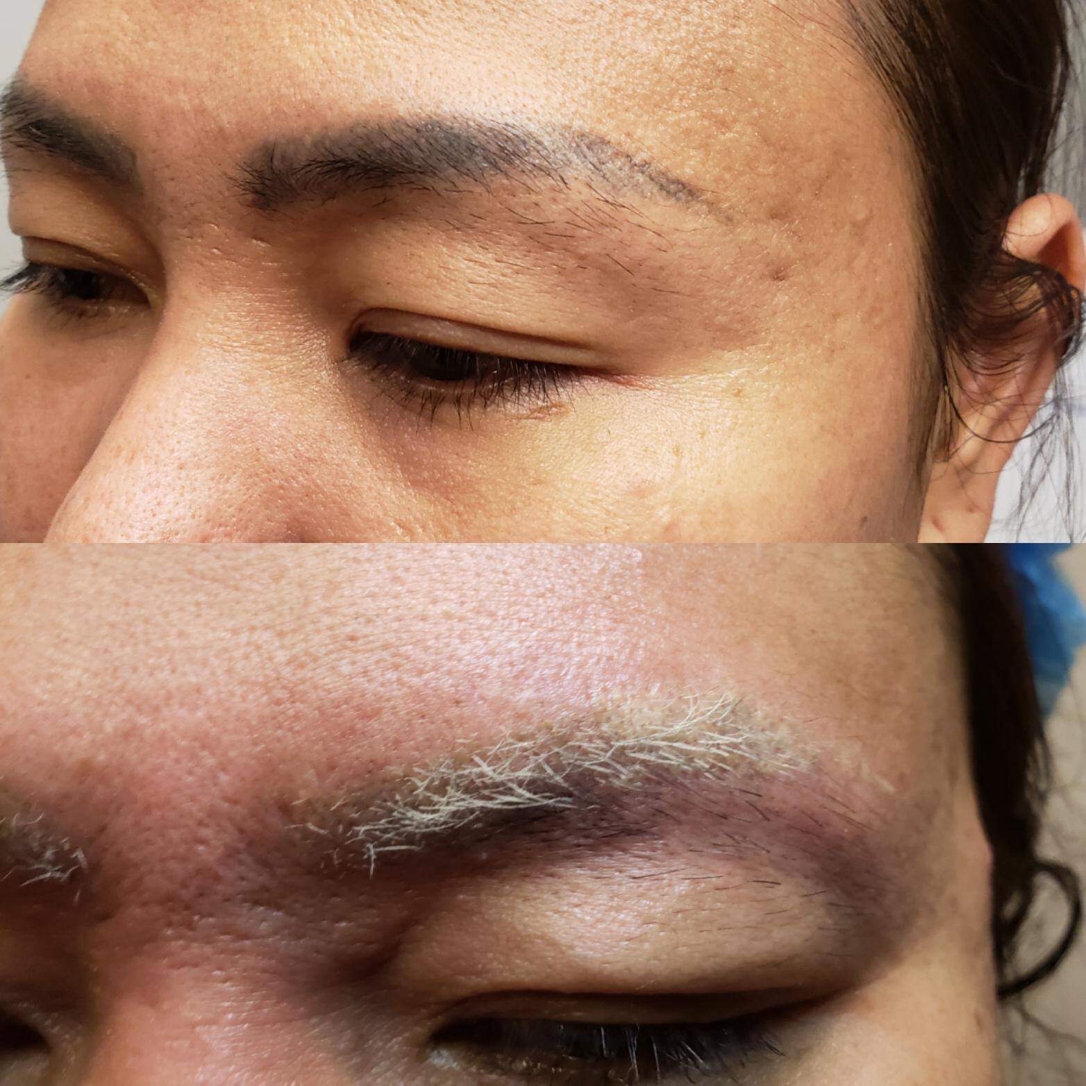 2 Day Laser Tattoo Removal Training Course Minnesota Brow & Lash