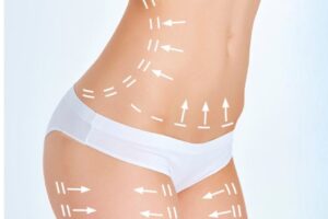 body-contouring-fat-cellulite-reduction