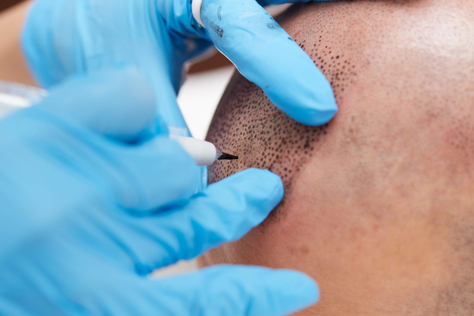 Scalp Pigmentation Training Course